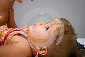 Baby Girl on Back Visible Blue Veins in Head and Frontal or Skull Bossing