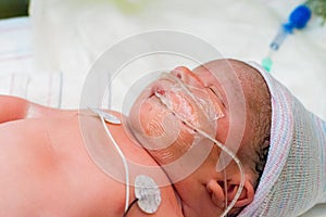 Baby With Medical Tubes