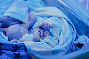 newborn baby lying under blue lamp because of bilirubin, phototherapy, he has jaundice