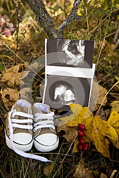 A baby`s ultrasound and shoes