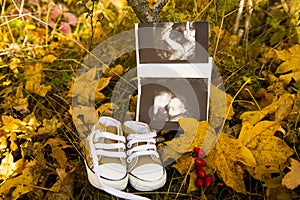 A baby`s ultrasound and shoes
