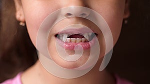 Baby teeth. Toothless smile. Cutting root tooth. The girl opens her lips and shows no front teeth. Close up