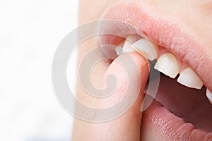 Baby tooth, close-up of the tooth that falls macro shot