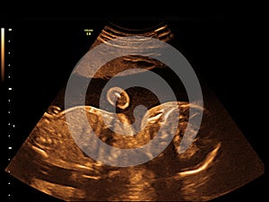 Baby on the ultrasound image