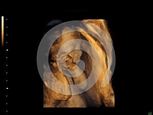 Baby on the ultrasound image