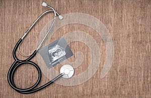 Baby ultrasound picture and stetoscope on wooden background