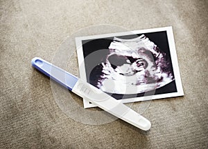 Baby ultrasound scan photo with pregnancy test photo