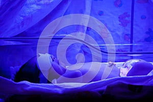 Baby under Phototherapy