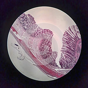 Bacillary dysentery, light micrograph