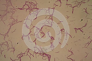 Bacillus anthracis anthrax 200x