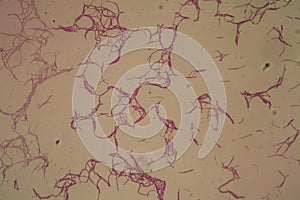 Bacillus anthracis anthrax 200x photo