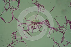 Bacillus anthracis anthrax  200x