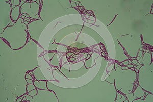 Bacillus anthracis anthrax  200x photo