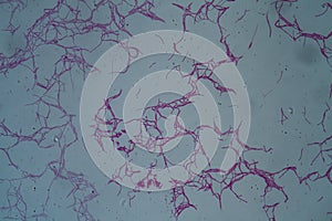 Bacillus anthracis anthrax  200x