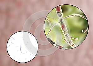 Bacillus anthracis, light micrograph and illustration