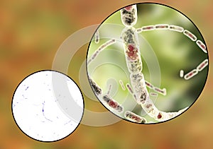 Bacillus anthracis, light micrograph and illustration