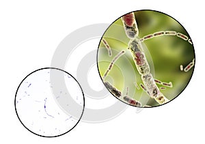 Bacillus anthracis, light micrograph and illustration