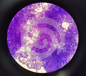 Bacillus cereus photo