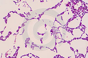 Bacillus gram positive stain under microscope view. Bacillus is rod-shaped bacteria