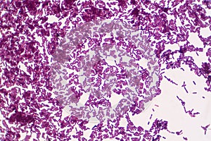 Bacillus gram positive stain under microscope view. Bacillus is rod-shaped bacteria photo