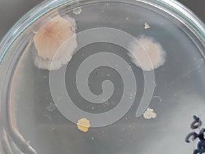 Bacillus and other bacteria and fungi growing on nutrient agar medium