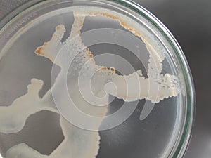 Bacillus and other bacteria growing on nutrient agar medium