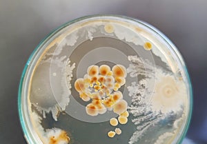 Bacillus subtilis other bacteria and fungi colonies on saboraud dextrose agar medium