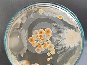 Bacillus subtilis other bacteria and fungi colonies on saboraud dextrose agar medium