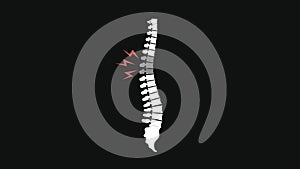 Back ache animated illustration with spine. Focused on spine vertebra region