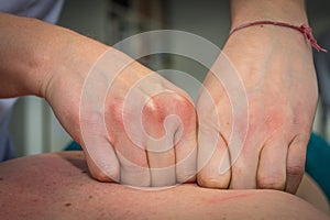 Back massage with knuckles, closeup to hands
