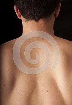 Back of the neck
