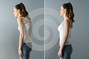 Back Pain Abdominal Posture Before