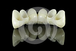 Back of Tooth Bridge