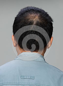 Back view of male hair head part bald