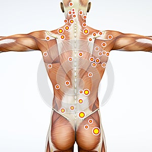 Back view of a man and his trigger points. Anatomy muscles. 3d rendering
