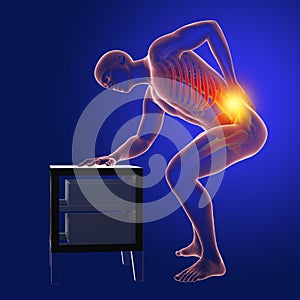 Backache, back pain, conceptual 3D illustration