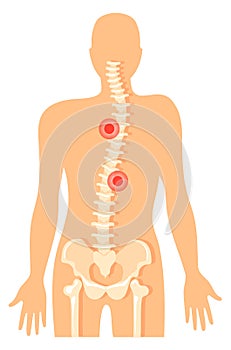 Backbone pain. Spine ache icon. Vertebral column diagram