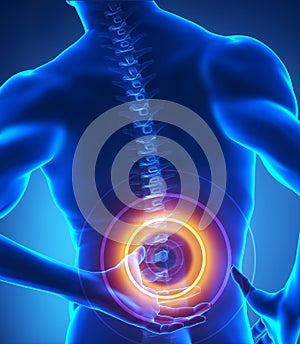 Backbone problem x-ray view photo