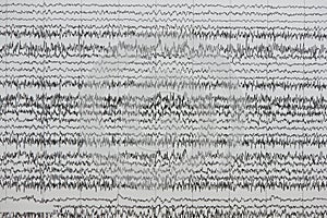 Background of brain waves on the paper