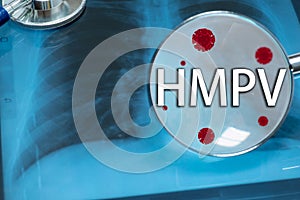 Background of Human Metapneumovirus (HMPV)