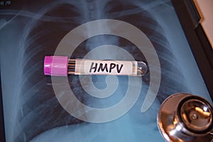 Background of Human Metapneumovirus (HMPV) RT-PCR Kit photo
