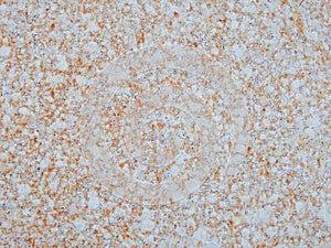 Background. shot of rusty metal. Rusty sheet of metal painted with paint. Rust seeping through white paint