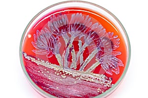 Lactobacillus bulgaricus from laboratory microbiology. photo