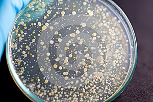 Backgrounds of Characteristics and Different shaped Colony of Bacteria and Mold growing on agar plates from Soil samples for educa