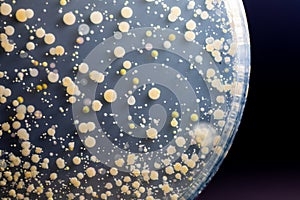 Backgrounds of Characteristics and Different shaped Colony of Bacteria and Mold growing on agar plates from Soil samples for educa