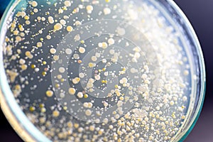 Backgrounds of Characteristics and Different shaped Colony of Bacteria and Mold growing on agar plates from Soil samples for educa