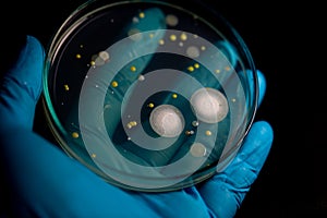 Backgrounds of Characteristics and Different shaped Colony of Bacteria and Mold growing on agar plates from Soil samples for educa