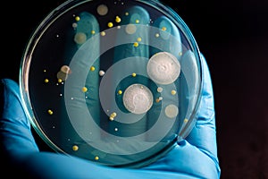 Backgrounds of Characteristics and Different shaped Colony of Bacteria and Mold growing on agar plates from Soil samples for educa