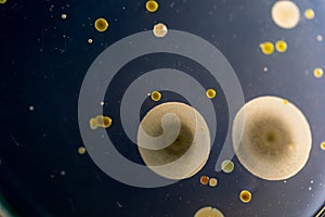 Backgrounds of Characteristics and Different shaped Colony of Bacteria and Mold growing on agar plates from Soil samples for educa