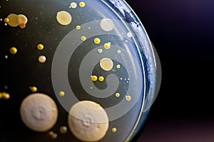 Backgrounds of Characteristics and Different shaped Colony of Bacteria and Mold growing on agar plates from Soil samples for educa